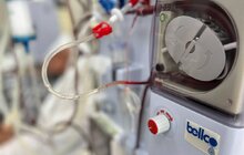 Фото 3: У лікарні святого Луки запрацювало відділення нефрології та діалізу