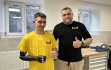 Фото 9: У центрі НЕЗЛАМНІ у Львові 24-річному захиснику встановили біонічний протез руки