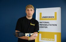 Фото 6: Протези для незламних: стартує благодійний збір на біонічні протези для українців (відео)