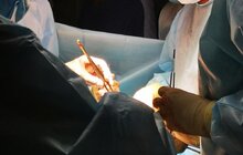 Фото 6: У Львові вперше в Україні пересадили підшлункову залозу