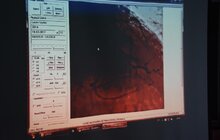 Фото 6: Львівські лікарі переймають кращі ізраїльські практики у лікуванні складних захворювань