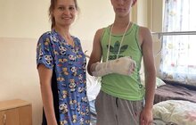 Фото 3: Медики у Львові врятували руку 17-річному хлопцю