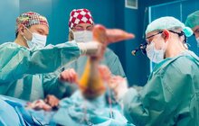 Фото 4: Пришили задом наперед: у Львові лікарі трьох міст виконали рідкісну операцію – ротаційну пластику