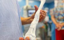 Фото 5: Вперше у Львові онкохворому хлопчику пересадили кістку, надруковану на 3D-принтері