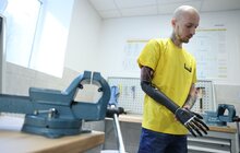 Фото 12: 100 протезів на місяць: Центр НЕЗЛАМНІ відкрив протезну майстерню (відео)