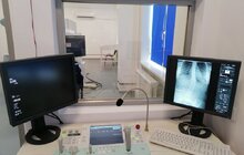 Фото 6: У дитячій лікарні на Орлика запрацював надсучасний рентгенівський апарат