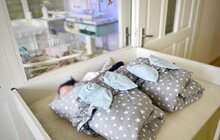 Фото 3: У львівській лікарні виходили близнят із переплетеними пуповинами, яким медики зберегли життя