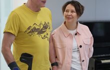 Фото 2: Перший в історії України пацієнт із вживленим у кістку протезом – ходить (фото, відео)
