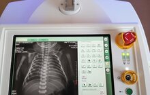 Фото 5: Для міської дитячої лікарні Львова придбали пересувний комп’ютерний рентгенограф
