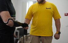 Фото 3: В центрі НЕЗЛАМНІ вставили 25-й біонічний протез руки: штучну кінцівку отримав 42-річний захисник
