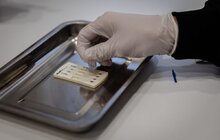 Фото 3: Безоплатно та конфіденційно: в AHF Checkpoint Львів можна пройти швидке тестування на ВІЛ, вірусні гепатити В,С та сифіліс
