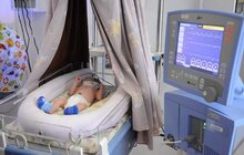 Фото 8: Щороку у Львові передчасно народжується близько 600 немовлят: як виходжують таких діток