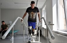 Фото 7: У центрі НЕЗЛАМНІ протезували 32-річного захисника, який у російському полоні втратив обидві ноги