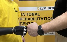 Фото 5: У центрі НЕЗЛАМНІ у Львові 24-річному захиснику встановили біонічний протез руки
