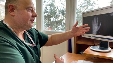 Фото: У Львові хірурги вперше запротезували суглоб кисті руки військовому