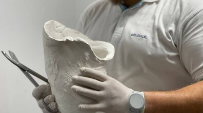 Фото: Національний реабілітаційний центр НЕЗЛАМНІ відкриває мобільну майстерню протезування: акредитація ЗМІ