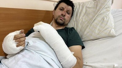 Фото: До Опікового центру Лікарні св. Луки госпіталізували двох пацієнтів з важкими опіками, отриманими внаслідок вибухів акумуляторів