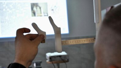 Фото: Спеціалісти центру НЕЗЛАМНІ удосконалили техніку виготовлення протезів