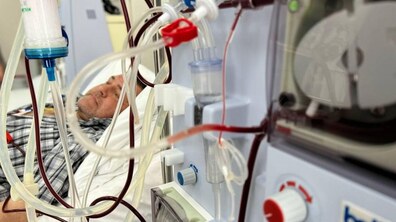 Фото: У лікарні святого Луки запрацювало відділення нефрології та діалізу