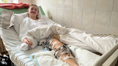 Фото: Львівські медики допомогли 18-річній дівчині повноцінно ходити