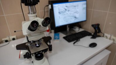 Фото: Львів отримав надсучасне обладнання для супроводу трансплантації на 98 млн грн