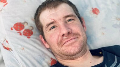 Фото: На лікування до Львова потрапив донеччанин, який отримав важкі ушкодження, рятуючи людей