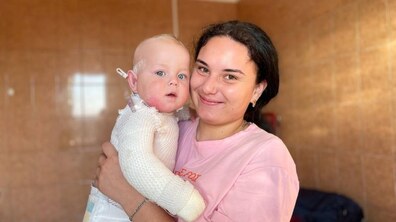 Фото: Лікарі врятували дев'ятимісячного малюка з опіками: як долучитись до розбудови системи дитячої реабілітації UNBROKEN KIDS