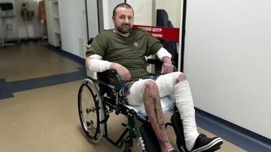 Пацієнт Олег у кріслі колісному в медичному закладі. Його руки та ноги забинтовані, що свідчить про нещодавні травми та лікування. На задньому плані видно коридор лікарні та логотип опікового центру.