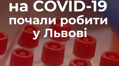 Фото: Тепер ПЛР-тести, які дозволять на ранній стадії виявляти інфікування коронавірусом, будуть робити у Львові, — А. Садовий