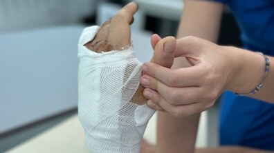 Фото: Львівські медики врятували військовому руку, яку сильно понівечив ворожий дрон