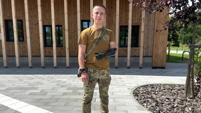 Фото: У центрі UNBROKEN 20-річному захисникові встановили біонічний протез руки