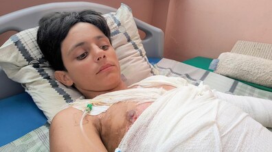 (Хлопець лежить з перебинтованим тулубом та рукою на ліжку в палаті. На тілі видно частину опіків