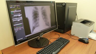 Фото: «Зараз на етапі монтування ще чотири рентген-апарати в закладах охорони здоров’я міста Львова», - В. Зуб