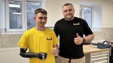 Фото: У центрі НЕЗЛАМНІ у Львові 24-річному захиснику встановили біонічний протез руки