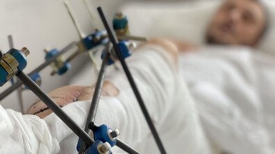 Фото: Львівські лікарі провели унікальну реконструктивну операцію