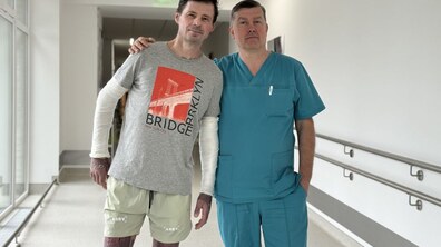 Фото: У Львові лікарі врятували чоловіка, який обпік 40% тіла