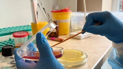 Фото: Скринінг вад плоду, жіноче і чоловіче здоров’я, онкомаркери: які сучасні аналізи можна здати у Другому медоб’єднанні Львова