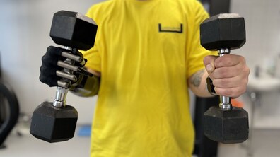 Фото: Військовий з Харкова отримав біонічний протез і планує повернутися на фронт