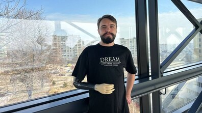 Фото: Мріє знову писати музику: в центрі UNBROKEN готується до протезування воїн, який втратив на війні руку