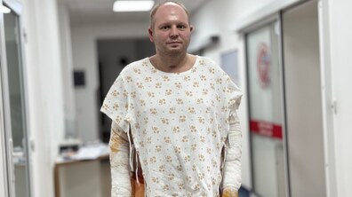 Фото: Надскладний випадок: львівські медики врятували життя священника, який отримав 70% опіків тіла через вибух котла