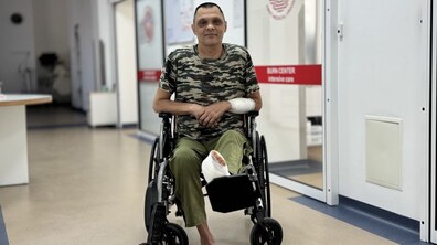 Фото: Львівські лікарі прооперували чоловіка, який через опік пальця ледь не втратив ногу